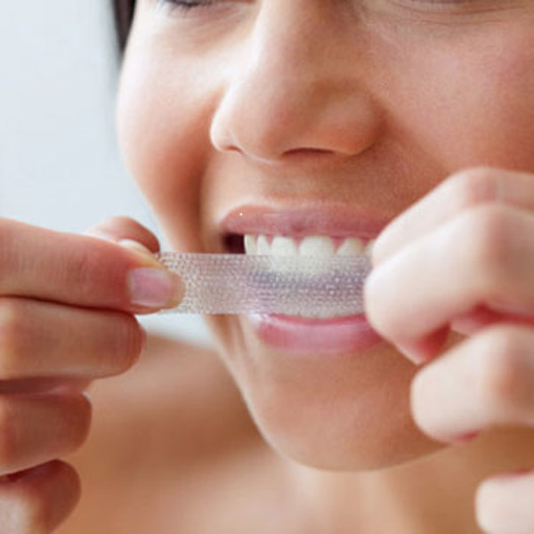 What is teeth whitening?