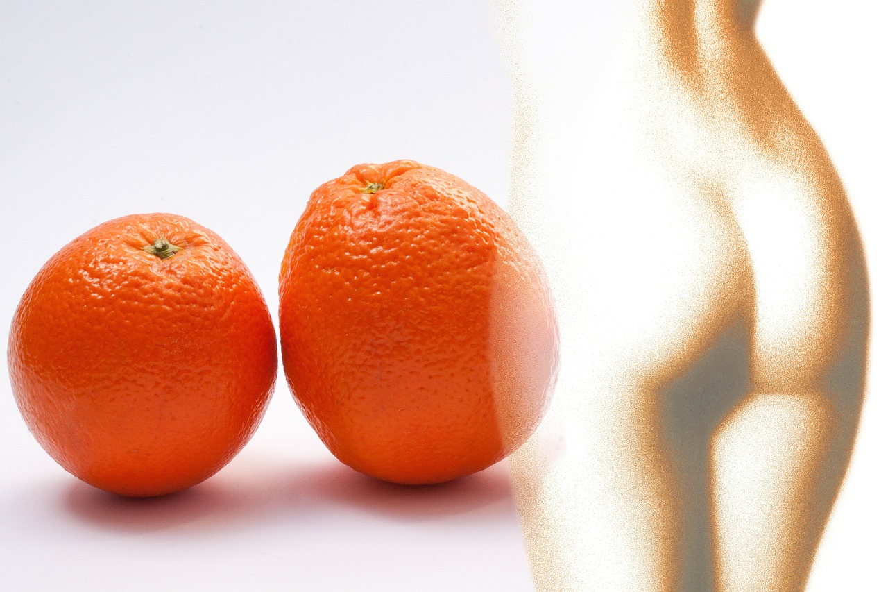 Orange peel - cellulite